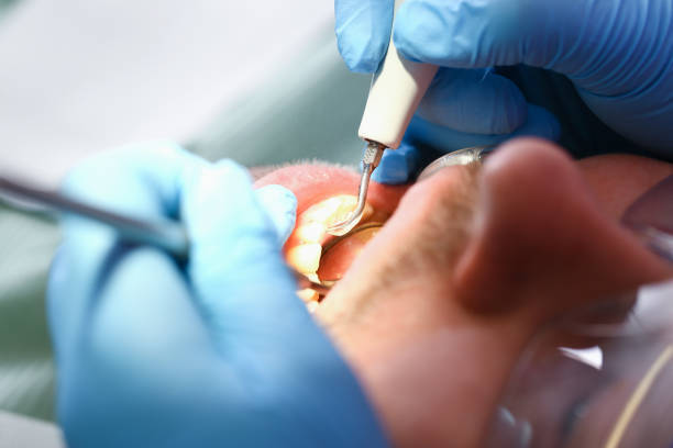 Best Broken or Chipped Tooth Repair in Winston, OR