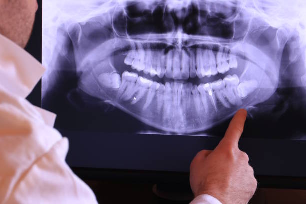 Best Urgent Dental Care for Toothaches in Winston, OR