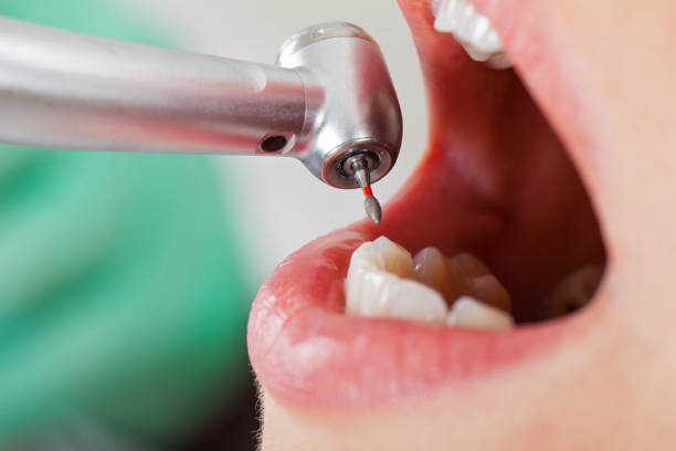 Best Emergency Dental Care for Sports Injuries in Winston, OR